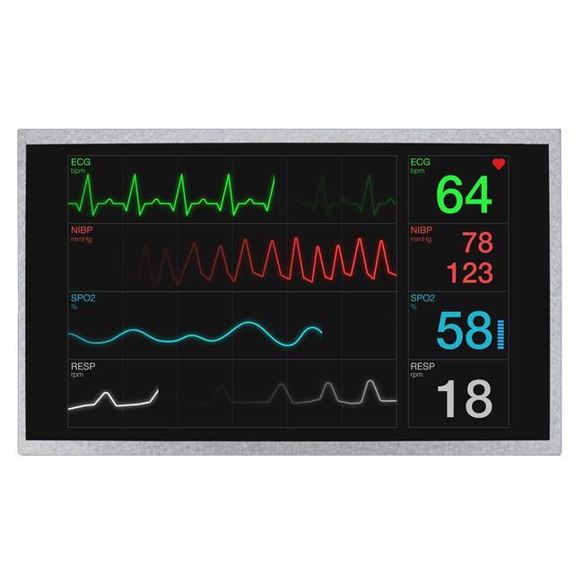 NHD-10.1-1024600BF-LSXP Newhaven Display Intl